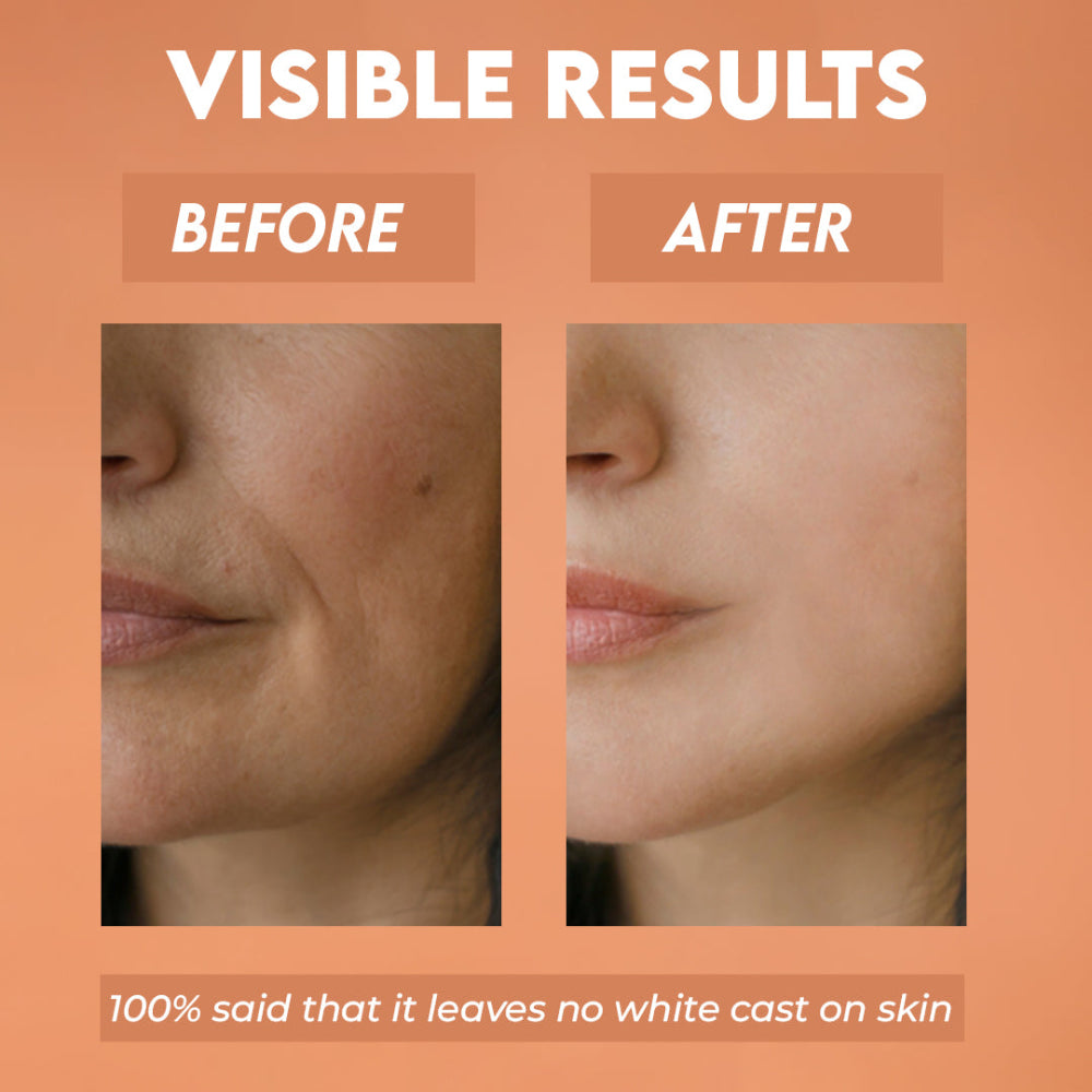 Jovees Sun Aqua Gel SPF 50 PA+++ | Lightweight, Gel Texture | 1% Hyaluronic Acid | Non-Greasy, No White Cast | Perfect for Oily & Combination Skin