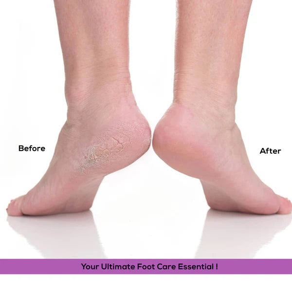 Ikonic Basics Stainless and Sand Paper Foot File IKB-727K