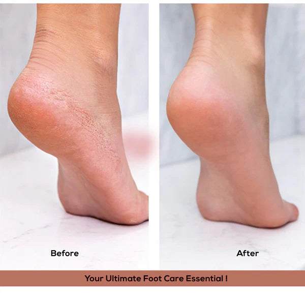 Ikonic Basics Foot File     IKB-707C